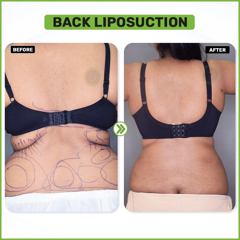 Before and After 14